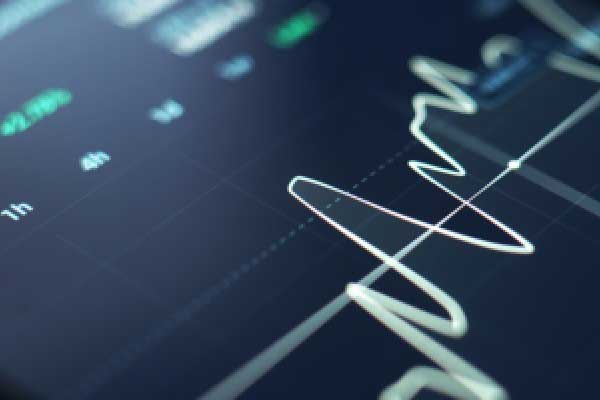 苹果公司表示人工智能将取代搜索引擎后 谷歌母公司Alphabet股价下跌7%